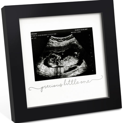 KeaBabies Solo Baby Sonogram Picture Frame - Black